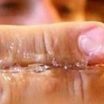 Как убрать суперклей с пальцев? Что делать если пальцы склеились?