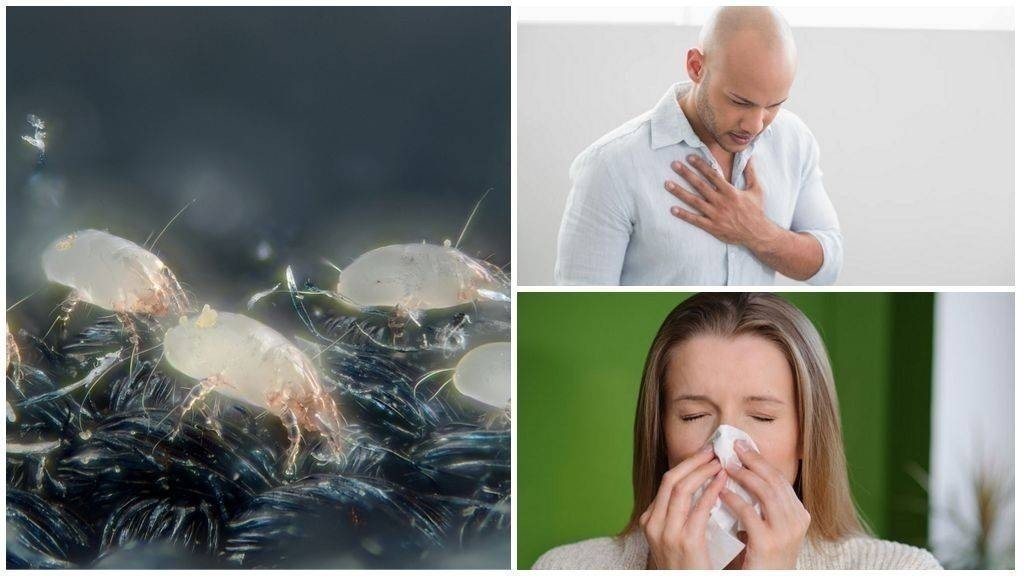Симптомы пылевой аллергии
